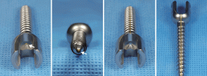 Monoaxial screw mjsurgical