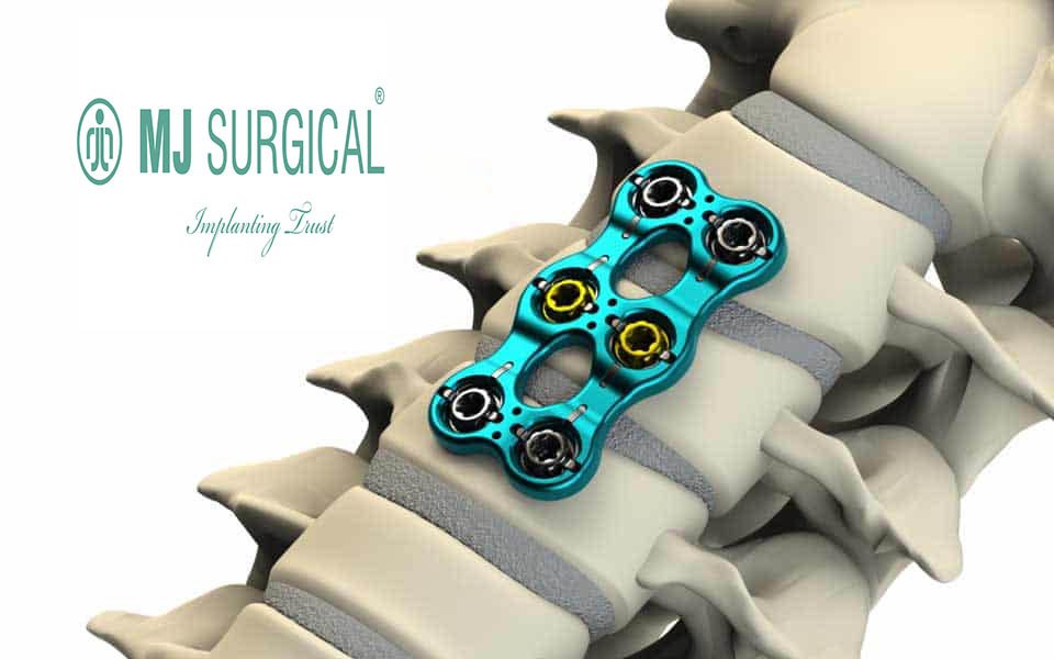 Anterior Cervical Plate