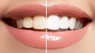 Does Teeth Whitening Gum Actually Work?