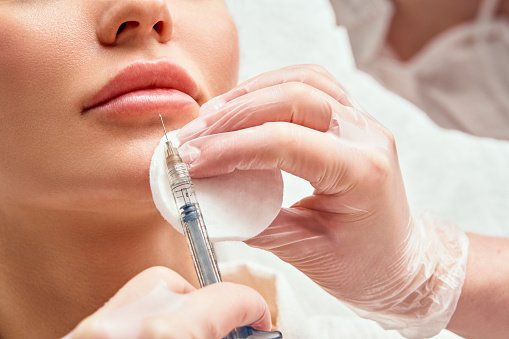 what to do after botox