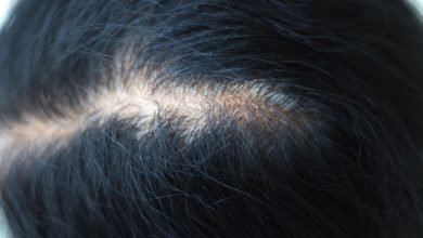medications that causes alopecia