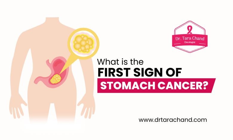 What-is-the-first-sign-of-stomach-cancer?-Dr-Tara-Chand-Gupta