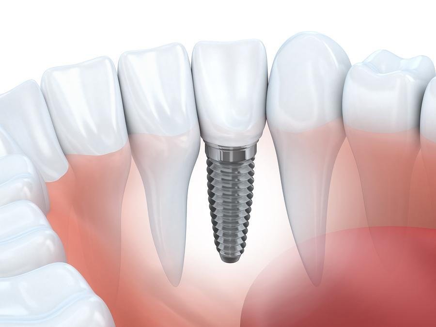 dental patients