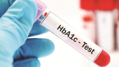 Exploring HbA1c Test Costs