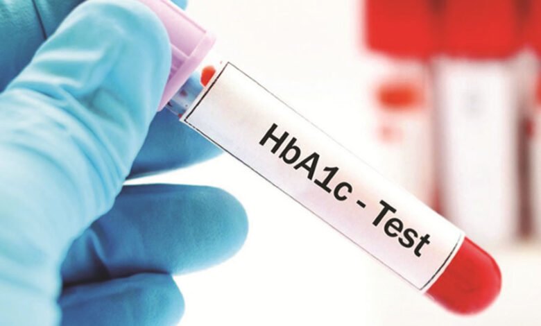 Exploring HbA1c Test Costs